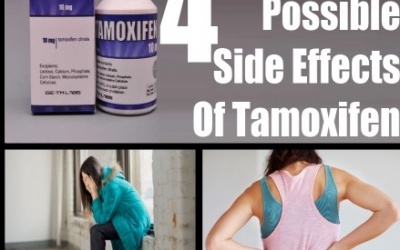 Thuốc tamoxifen có thể là 'kẻ thù' của mắt