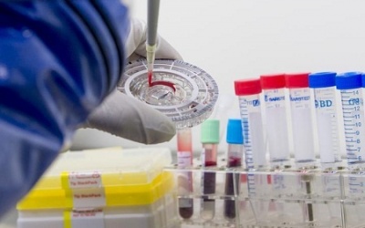 Đã có phương pháp lấy máu không đau