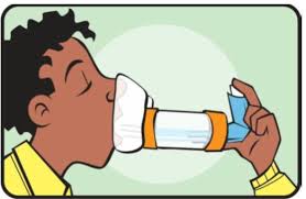 Miễn phí khám, tư vấn và cấp phát thuốc cho bệnh nhân hen phế quản tại Bạch Mai