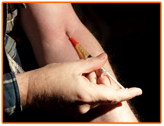 Dùng chung kim tiêm với người có HIV liệu có nhiễm virus?