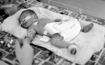 Bú sữa mẹ - Trẻ sinh non giảm nguy cơ viêm ruột hoại tử 