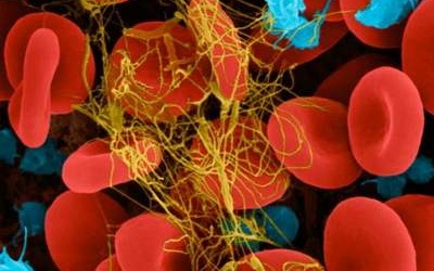 Phát hiện ký sinh trùng trong máu bằng smartphone