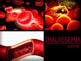 Việt Nam có hơn 10 triệu người mang gen bệnh tan máu bẩm sinh