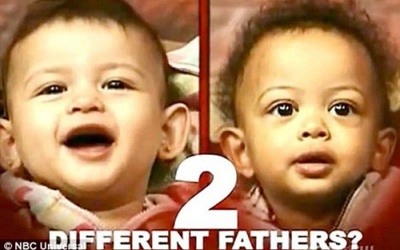 Hy hữu cặp sinh đôi cùng mẹ khác cha