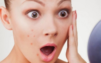 Video: 5 loại thực phẩm giúp phòng ngừa mụn trứng cá