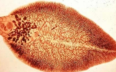 Cách phòng tránh bệnh sán lá gan