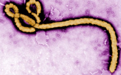 Phát hiện virus Ebola trong mắt một bác sỹ sau khi khỏi bệnh