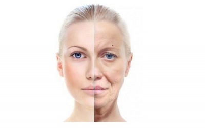 Rối loạn stress hậu sang chấn khiến lão hóa sớm