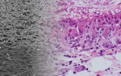 Mạch máu nhân tạo được thử nghiệm thành công