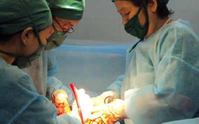 Khối u nặng hơn 3 kg trong tử cung một phụ nữ