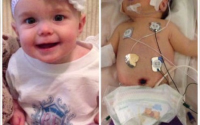 Bé gái chào đời với bàng quang nằm ngoài cơ thể