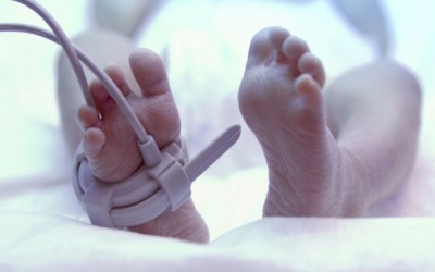 Bé trai 8 tháng tuổi không có hậu môn