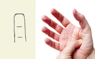 Tê các đầu ngón tay là bị làm sao?