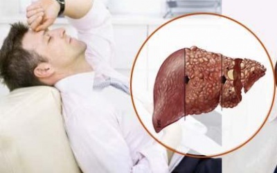 Cách phòng tránh ung thư cho người bị viêm gan B mạn tính