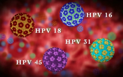 Yếu tố tăng nguy cơ ung thư cổ tử cung