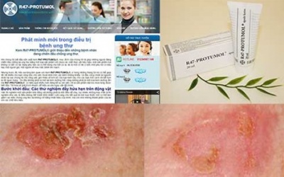 Chỉ xoa kem là hết ung thư vú (?!)