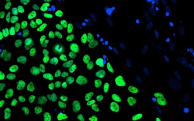 'Sửa chữa' cơ tim bằng tế bào gốc