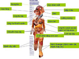 Gần 98% các bệnh ung thư phổi liên quan đến thuốc lá