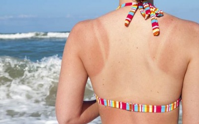 Video: Hướng dẫn làm 'kem' chữa trị cháy nắng tại nhà