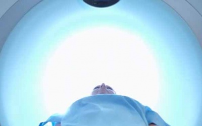 Tác dụng phụ của tia xạ trong điều trị ung thư là gì?