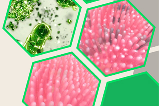 ImmuneGamma - bí mật triệu đô tiết lộ từ nhà nước Liên Xô