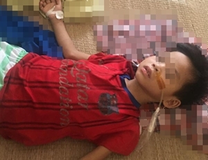 Bé trai 7 tuổi phải cắt bỏ 2/3 dạ dày do uống nhầm acid đựng trong chai la Vie