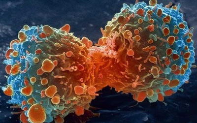 7 sự thật chúng ta cần biết về ung thư