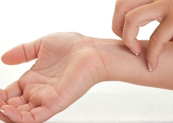 Nổi mẩn đỏ, ngứa khắp người vào mùa hè là bệnh gì?