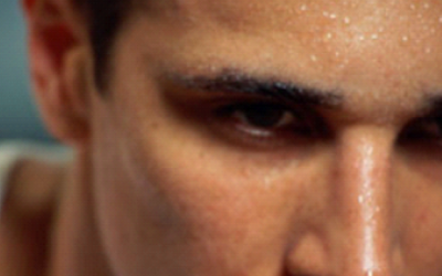 Ung thư tuyến mồ hôi - Hiếm gặp nhưng nguy hiểm