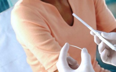 Que cấy tránh thai - Phương pháp tránh thai an toàn cho giới trẻ