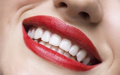 10 cách làm trắng răng đơn giản không ngờ