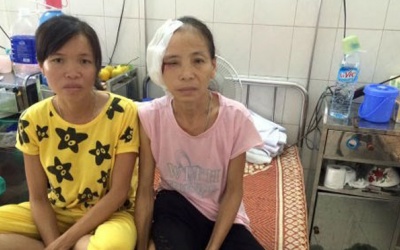 Ung thư da lại đắp thuốc Nam, biến chứng vào tận xương