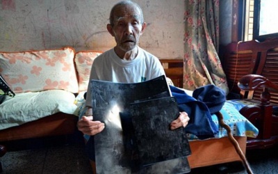 Đạn ghim trong xương 60 năm không biết