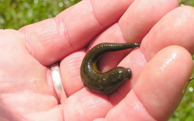 Khạc ra máu do bị đỉa chui vào cuống họng