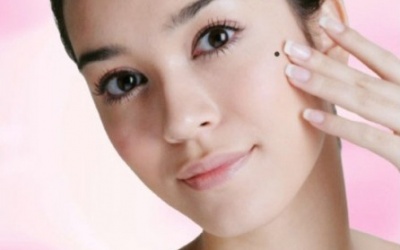 Nốt ruồi có lông có phải là nốt ruồi ác tính?