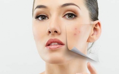 Loại bỏ mụn do dị ứng mỹ phẩm
