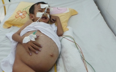 Xót xa những thân bệnh lay lắt chờ nguồn tạng hiến