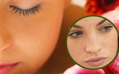 Nám da tuổi trung niên: Phải trị từ bên trong!