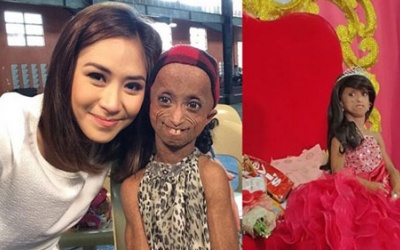 Cô gái 18 có thân hình của bà lão 144 tuổi