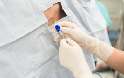 Chẩn đoán viêm màng nào không đau đớn