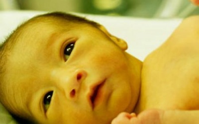Trẻ sơ sinh bị vàng da có nguy hiểm không?