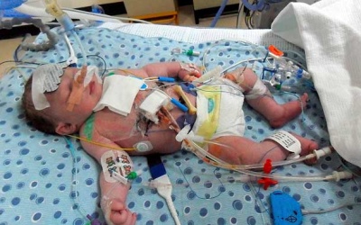 Thiếu trang thiết bị, bệnh nhân tim mạch xếp hàng dài chờ mổ