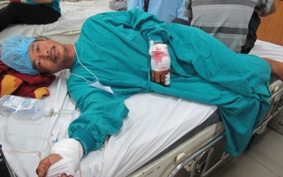 Khỉ đứt xích cắn nát hai bàn tay ông chủ