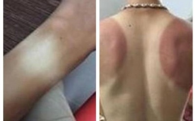 Hãy mua ngay áo chống nắng cho chồng!