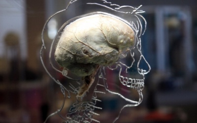 Đột quỵ - 'Kẻ cướp' trí nhớ của con người