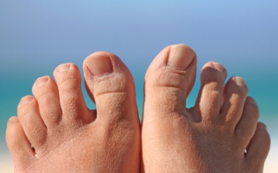 5 lầm tưởng về bệnh gout