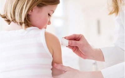 Lưu ý khi dùng chất sát khuẩn có iod