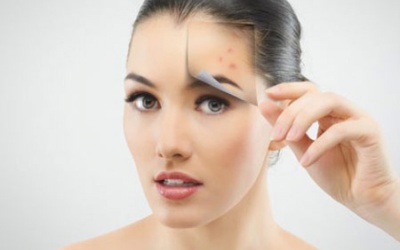 7 thực phẩm là 'khắc tinh' của mụn trứng cá