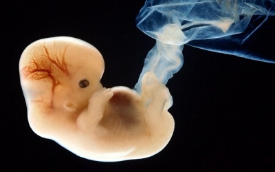 Tia vũ trụ gây dị tật thai nhi