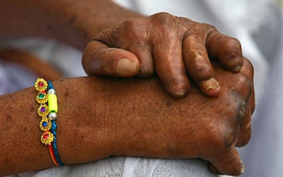 Sẽ loại trừ bệnh phong trên toàn quốc vào cuối năm 2015